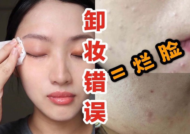Beauty blogger cảnh báo: Chị em đang huỷ hoại chính làn da của mình ngay từ bước tẩy trang - Ảnh 3.
