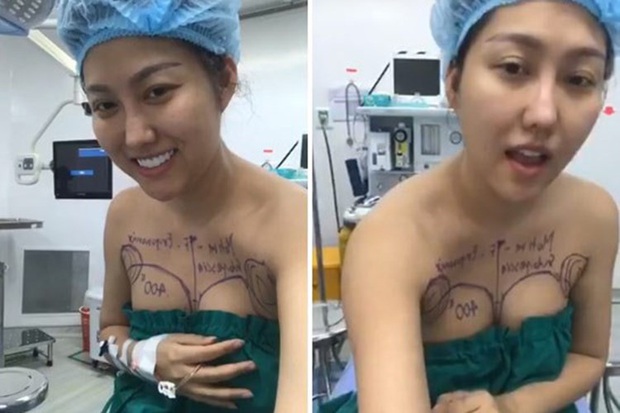 6 sao Việt khổ sở vì dao kéo biến dạng: Angela Phương Trinh lệch hẳn 1 bên mũi, Hồ Quỳnh Hương - Phi Thanh Vân gây choáng - Ảnh 3. 6 sao Việt khổ sở vì dao kéo biến dạng: Angela Phương Trinh lệch hẳn 1 bên mũi, Hồ Quỳnh Hương - Phi Thanh Vân gây choáng - Ảnh 3.