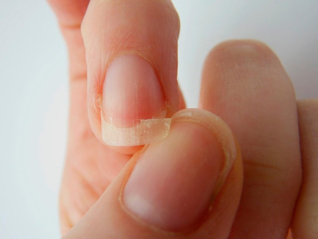 Quan sát đôi tay, nếu thấy có 3 tín hiệu xấu thì nên chú ý sức khỏe vì nguy cơ mắc bệnh về gan rất cao - Ảnh 1. Quan sát đôi tay, nếu thấy có 3 tín hiệu xấu thì nên chú ý sức khỏe vì nguy cơ mắc bệnh về gan rất cao - Ảnh 1.