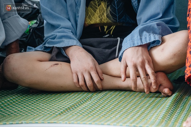 Người thân xót xa khi gặp lại cậu bé 15 tuổi bị chủ quán bánh xèo bạo hành, hy vọng cháu sớm về quê tiếp tục việc học - Ảnh 5.