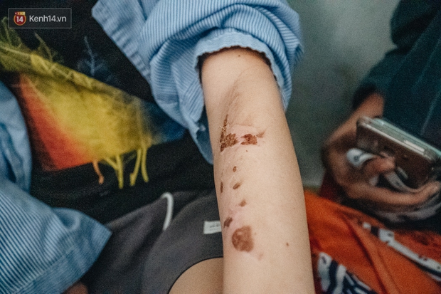 Người thân xót xa khi gặp lại cậu bé 15 tuổi bị chủ quán bánh xèo bạo hành, hy vọng cháu sớm về quê tiếp tục việc học - Ảnh 6.