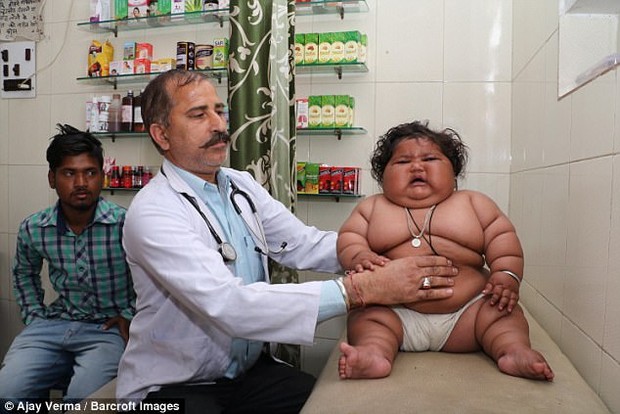 Bé gái béo nhất thế giới 8 tháng tuổi đã nặng gần 20kg, từng khiến truyền thông thế giới phải ngỡ ngàng 3 năm trước giờ ra sao? - Ảnh 7.