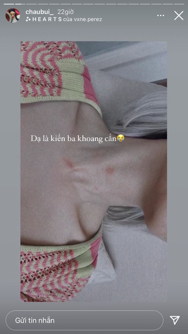 Cổ Châu Bùi xuất hiện vết lạ, sợ dân mạng nghĩ là hickey giống Ngọc Trinh hay sao mà vội thanh minh thế này - Ảnh 2.