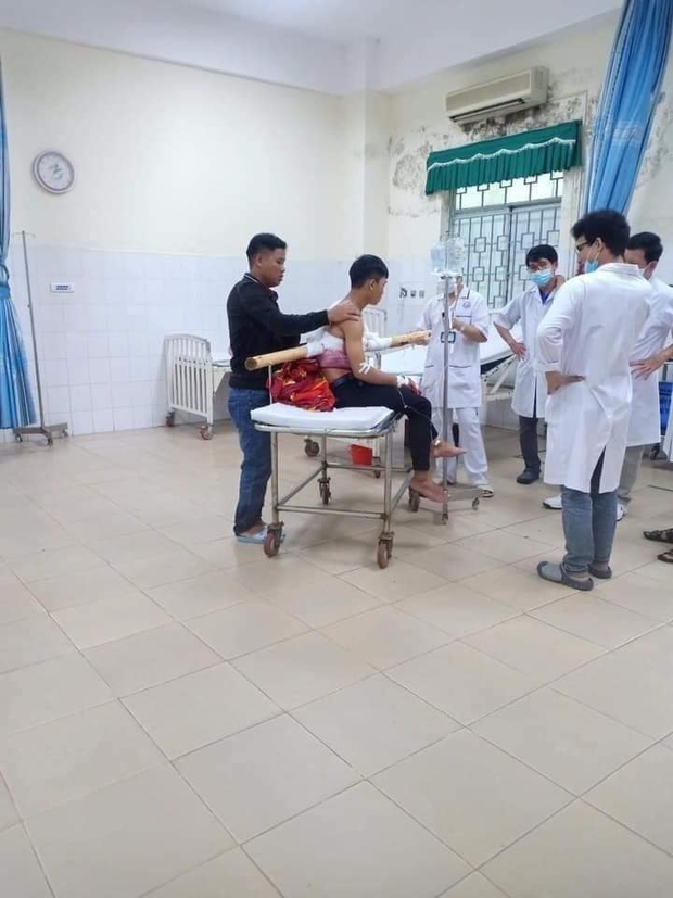 Kinh hoàng nam sinh 16 tuổi chạy xe máy bị cây keo đâm xuyên người - Ảnh 1.