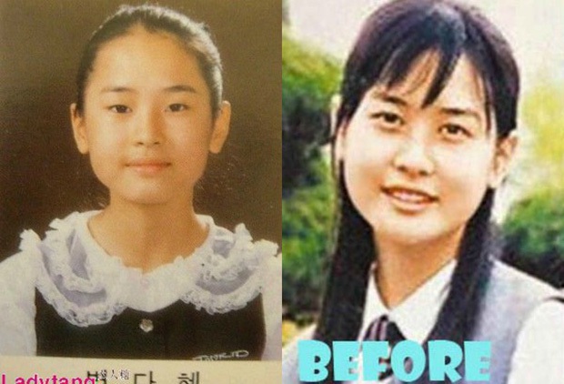 Nữ hoàng dao kéo Lee Da Hae lộ diện với gương mặt khác lạ, dấy lên nghi vấn nghiện dao kéo đến mức biến chứng - Ảnh 5.