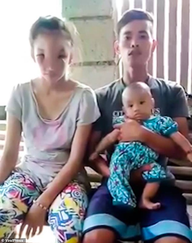 Nặn nốt mụn khó chịu trên mũi, bà mẹ tuổi teen nào ngờ mắc phải chứng bệnh lạ khiến nhan sắc hủy hoại, không ai nhận ra - Ảnh 3. Nặn nốt mụn khó chịu trên mũi, bà mẹ tuổi teen nào ngờ mắc phải chứng bệnh lạ khiến nhan sắc hủy hoại, không ai nhận ra - Ảnh 3.