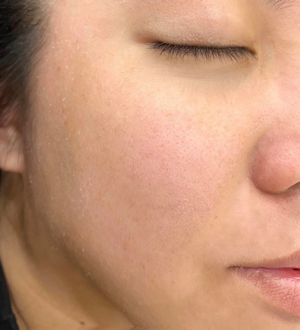 Da đang bong tróc, cô nàng tìm ra loạt sản phẩm hô biến da thành căng mượt, không thấy lỗ chân lông trong cả mùa đông - Ảnh 1. Da đang bong tróc, cô nàng tìm ra loạt sản phẩm hô biến da thành căng mượt, không thấy lỗ chân lông trong cả mùa đông - Ảnh 1.