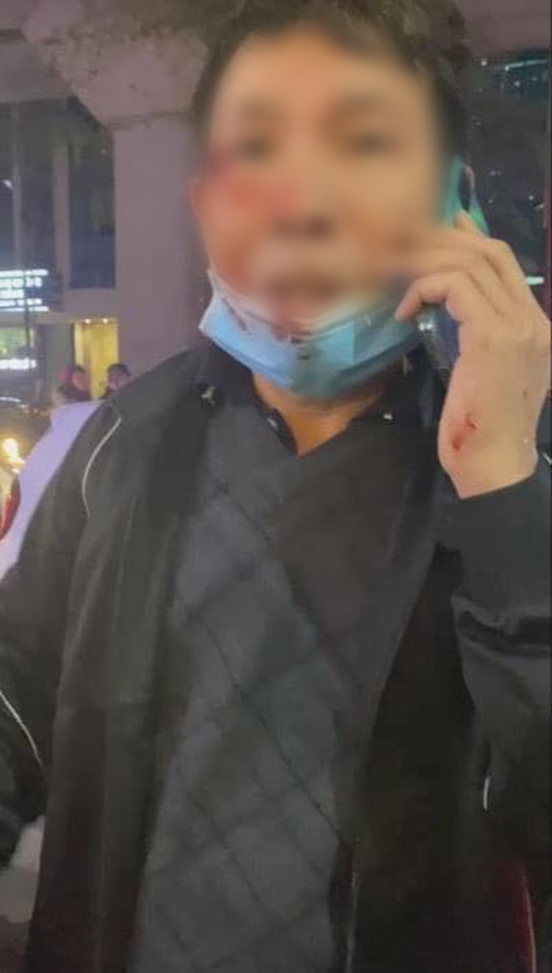 Cô gái đánh chảy máu mặt tài xế taxi vì chở nhầm địa chỉ rồi nhận cú tát “trời giáng” của nam thanh niên hot trên mạng xã hội - Ảnh 2.