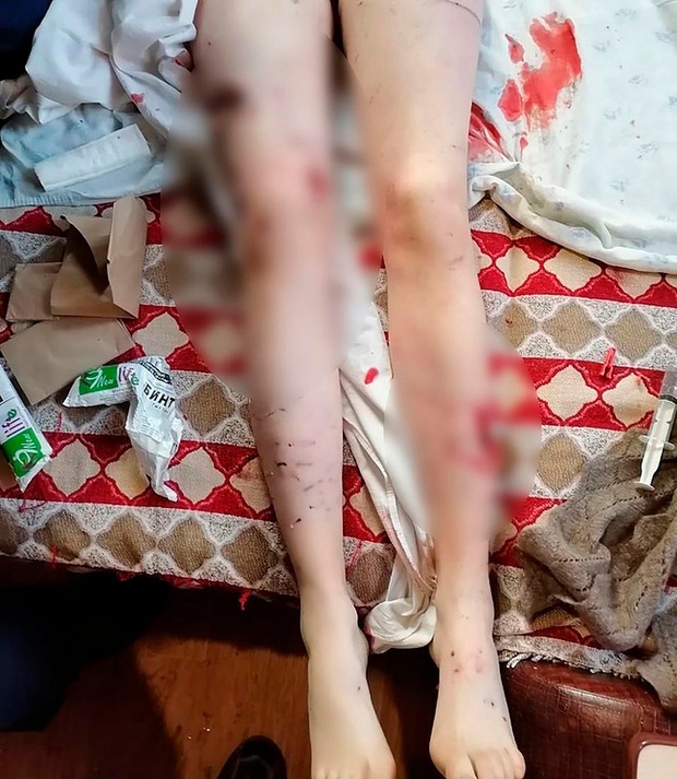 Nghe tiếng hét kinh hoàng, người dân vội ra xem rồi bàng hoàng trước cảnh tượng ám ảnh dưới nền tuyết phủ trắng xóa - Ảnh 4.