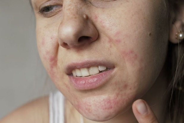 3 vị trí trên cơ thể luôn có cảm giác ngứa ngáy thì chị em nên cảnh giác với nguy cơ mắc ung thư cổ tử cung - Ảnh 1. 3 vị trí trên cơ thể luôn có cảm giác ngứa ngáy thì chị em nên cảnh giác với nguy cơ mắc ung thư cổ tử cung - Ảnh 1.