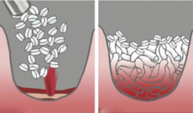 Đây là 4 phát minh siêu đỉnh từng khiến cả thế giới phải trầm trồ, tiềm năng cứu mạng cả triệu người mỗi năm - Ảnh 4.