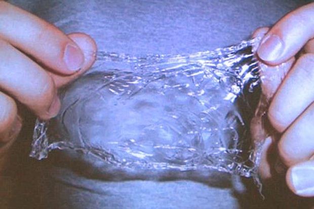 Đây là 4 phát minh siêu đỉnh từng khiến cả thế giới phải trầm trồ, tiềm năng cứu mạng cả triệu người mỗi năm - Ảnh 8.