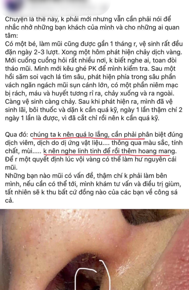 TP.HCM: Cô gái 22 tuổi suy sụp tinh thần, uống 30 viên thuốc tự tử vì bị bác sĩ thẩm mỹ dỏm phá nát mũi - Ảnh 2.