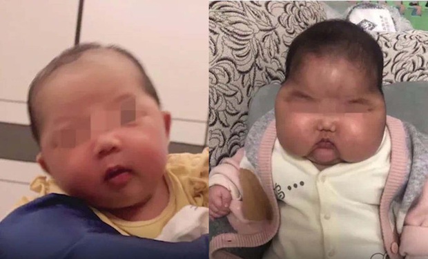 Sự cố “em bé đầu to” chấn động Trung Quốc, hàng loạt kem dưỡng da em bé bị thu hồi khiến phụ huynh hoang mang - Ảnh 1. Sự cố “em bé đầu to” chấn động Trung Quốc, hàng loạt kem dưỡng da em bé bị thu hồi khiến phụ huynh hoang mang - Ảnh 1.