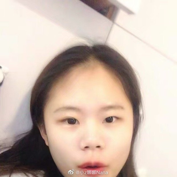Hotgirl phẫu thuật thẩm mỹ hơn 100 lần tiết lộ ảnh mặt mộc chưa dao kéo và khuyên fan: Em mới 8 - 9 tuổi, đừng học theo chị - Ảnh 2. Hotgirl phẫu thuật thẩm mỹ hơn 100 lần tiết lộ ảnh mặt mộc chưa dao kéo và khuyên fan: Em mới 8 - 9 tuổi, đừng học theo chị - Ảnh 2.