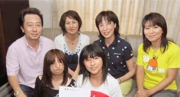 Bé gái sinh ra có gương mặt biến dạng, từng là nạn nhân của bạo lực học đường nhưng cuộc sống hiện tại khiến những ai dè bỉu phải xấu hổ - Ảnh 3.