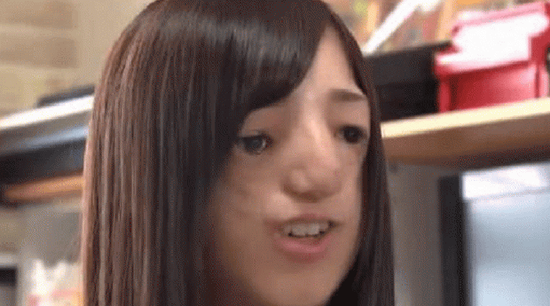 Bé gái sinh ra có gương mặt biến dạng, từng là nạn nhân của bạo lực học đường nhưng cuộc sống hiện tại khiến những ai dè bỉu phải xấu hổ - Ảnh 4.