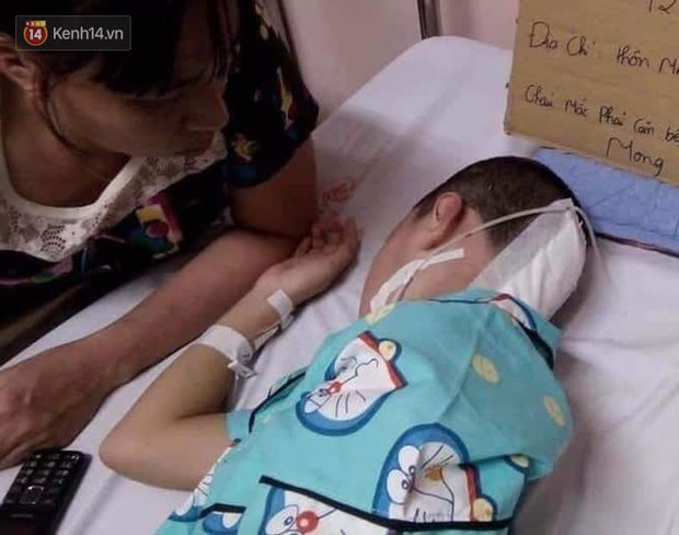 Cô bé 12 tuổi phẫu thuật não để điều trị ung thư: Trước đây con xinh lắm, giờ xạ trị nhiều nên chẳng còn tóc nữa - Ảnh 2. Cô bé 12 tuổi phẫu thuật não để điều trị ung thư: Trước đây con xinh lắm, giờ xạ trị nhiều nên chẳng còn tóc nữa - Ảnh 2.