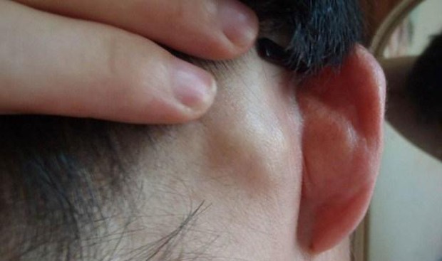 2 vị trí trên cơ thể không nên hickey kiss kẻo ảnh hưởng xấu tới sức khỏe - Ảnh 3. 2 vị trí trên cơ thể không nên hickey kiss kẻo ảnh hưởng xấu tới sức khỏe - Ảnh 3.