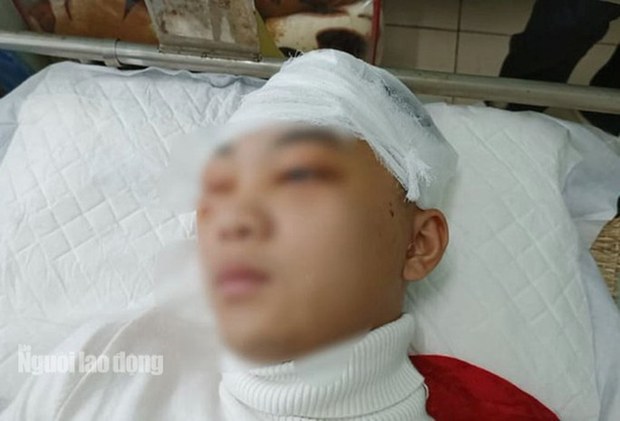 Nam sinh lớp 11 bị đánh vỡ sọ não chuyển viện tiếp tục điều trị - Ảnh 1.