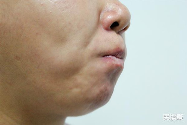 Bỗng thấy miệng xuất hiện 3 điều lạ nghĩa là ung thư đã hình thành, bạn nên đi khám khẩn cấp - Ảnh 2. Bỗng thấy miệng xuất hiện 3 điều lạ nghĩa là ung thư đã hình thành, bạn nên đi khám khẩn cấp - Ảnh 2.