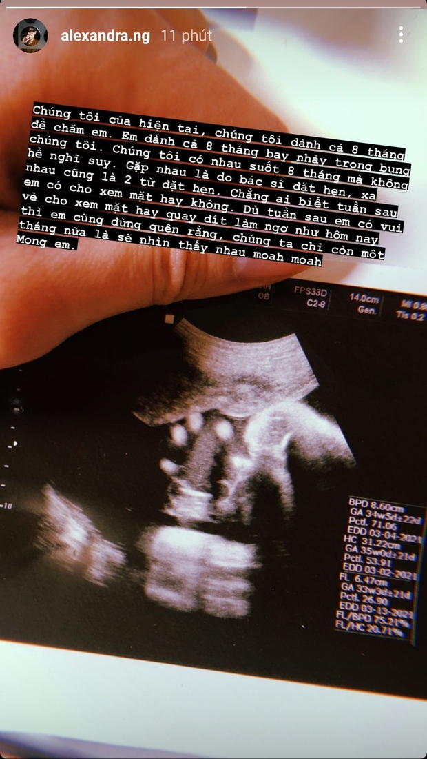 Alex - người yêu đồng giới của An Nguy bất ngờ tham gia thử thách văn mẫu 2021 do chính Sơn Tùng sáng tạo - Ảnh 2.