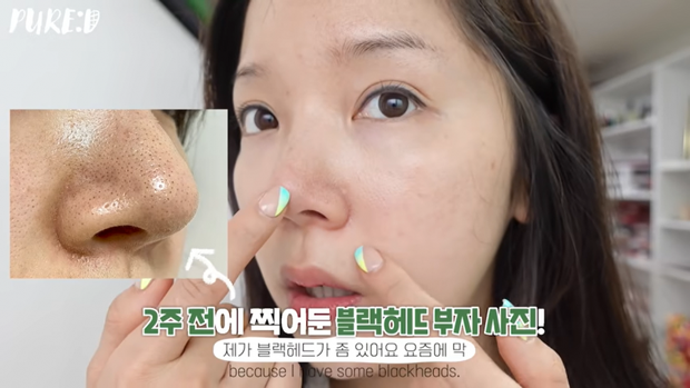 Nặn mụn “thô bạo” là sai cực kỳ, beauty blogger Hàn mách cách lấy mụn đầu đen với Vaseline siêu nhẹ nhàng và không hại da - Ảnh 11. Nặn mụn “thô bạo” là sai cực kỳ, beauty blogger Hàn mách cách lấy mụn đầu đen với Vaseline siêu nhẹ nhàng và không hại da - Ảnh 11.
