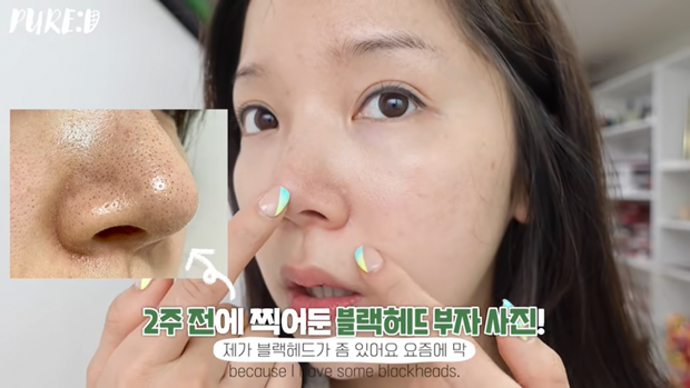 Nặn mụn “thô bạo” là sai cực kỳ, beauty blogger Hàn mách cách lấy mụn đầu đen với Vaseline siêu nhẹ nhàng và không hại da - Ảnh 11.