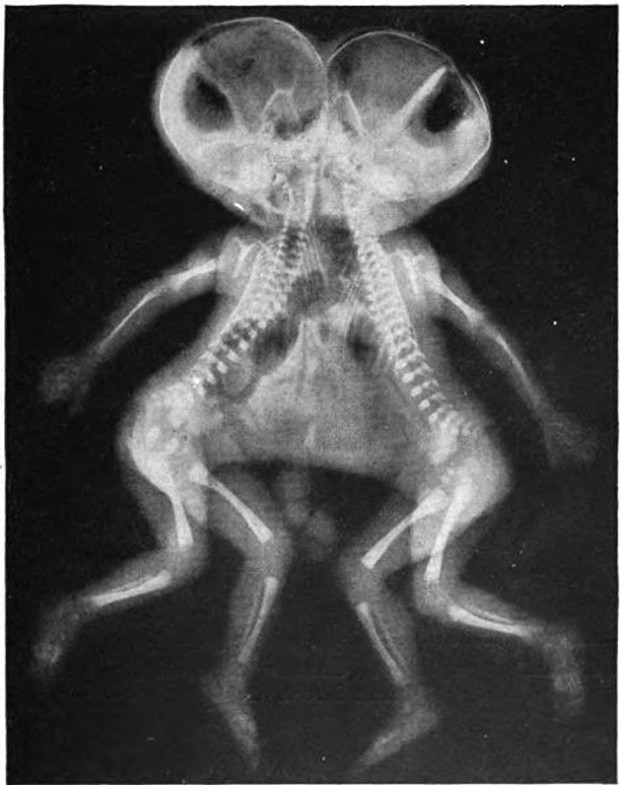 Những hình chụp X quang kỳ lạ nhưng thú vị sau đây sẽ cho bạn cơ hội nhìn mọi vật từ “ tận sâu bên trong”, thử xem bạn nhìn ra là gì không nhé? - Ảnh 10.
