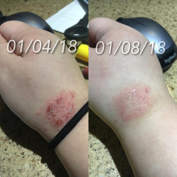Gần 230 ngàn người trên Sephora phát rồ vì hũ kem dưỡng to oạch này, nhìn kết quả hiểu ngay lý do tại sao - Ảnh 5. Gần 230 ngàn người trên Sephora phát rồ vì hũ kem dưỡng to oạch này, nhìn kết quả hiểu ngay lý do tại sao - Ảnh 5.