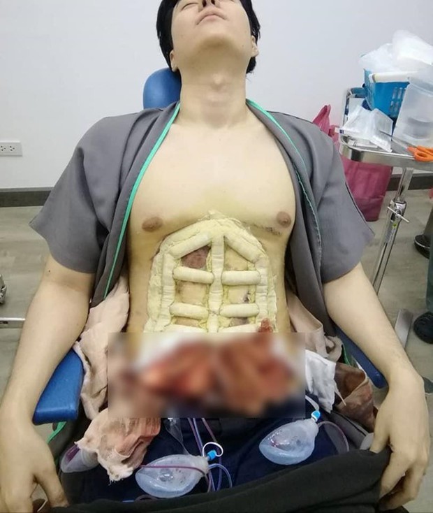 Lỡ say bye là bye luôn bài tập bụng vật vã: Bỏ ra 90 triệu cho chiếc bụng 6 múi, bạn có dám thử? - Ảnh 6.