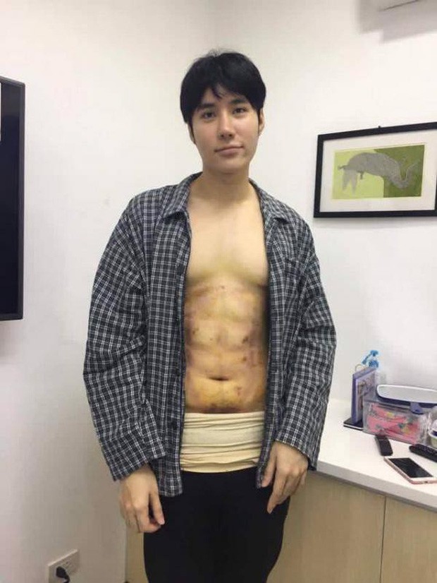 Lỡ say bye là bye luôn bài tập bụng vật vã: Bỏ ra 90 triệu cho chiếc bụng 6 múi, bạn có dám thử? - Ảnh 10.