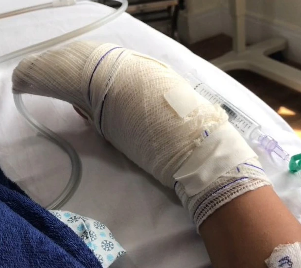 Ngón tay cái của cô gái bị sưng đau, chảy mủ sau khi làm móng, bị viêm mô tế bào, bác sĩ chỉ định phải cắt cụt để giữ tính mạng - Ảnh 4.