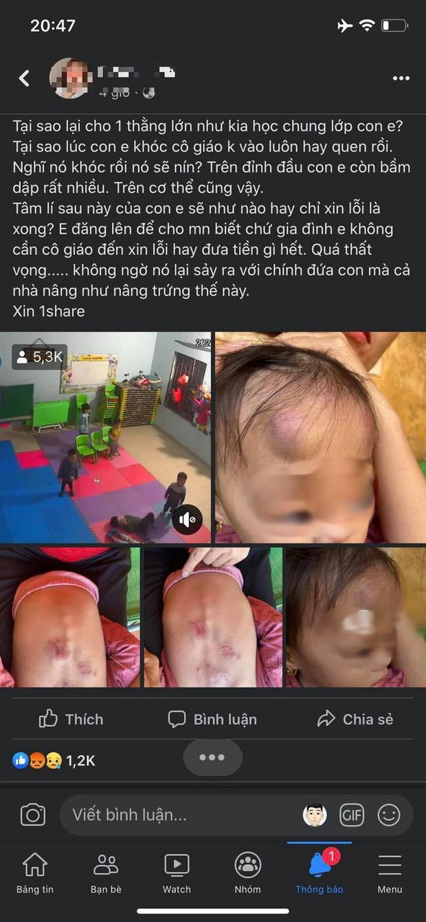 Bé gái 2 tuổi bị bạn học đánh ở Bắc Giang: Ảnh hưởng tâm lý mới là điều đáng lo! - Ảnh 1. Bé gái 2 tuổi bị bạn học đánh ở Bắc Giang: Ảnh hưởng tâm lý mới là điều đáng lo! - Ảnh 1.