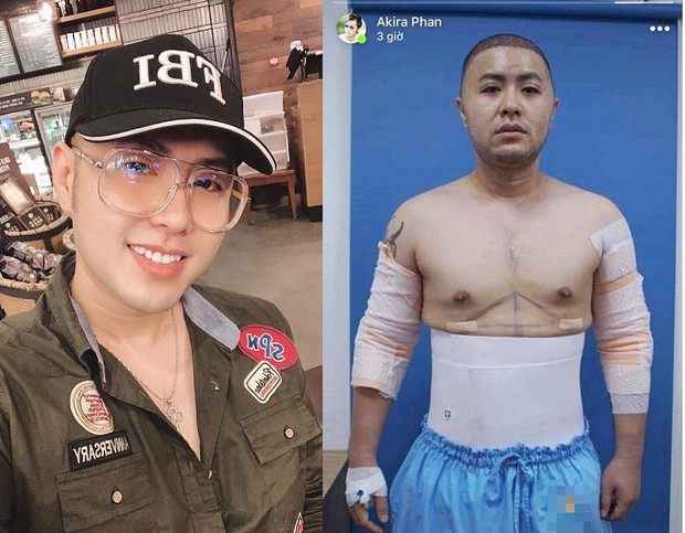 Lỡ say bye là bye luôn bài tập bụng vật vã: Bỏ ra 90 triệu cho chiếc bụng 6 múi, bạn có dám thử? - Ảnh 15.