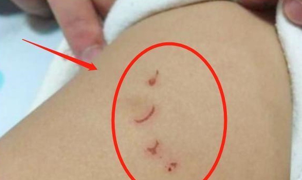 Anh trai ngày nào cũng đòi bế em gái mới sinh, nhưng đứa bé cứ khóc lớn khi thấy anh, mẹ lật người lên thì thấy sự thật quá sốc - Ảnh 3. Anh trai ngày nào cũng đòi bế em gái mới sinh, nhưng đứa bé cứ khóc lớn khi thấy anh, mẹ lật người lên thì thấy sự thật quá sốc - Ảnh 3.
