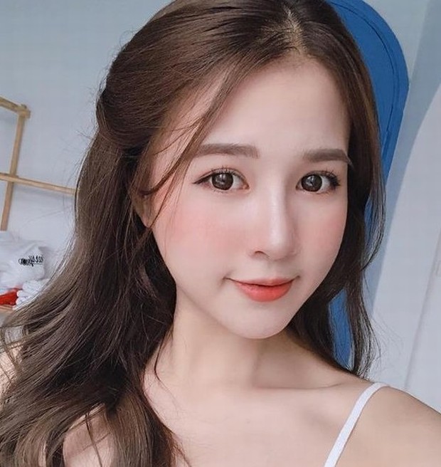 Nâng mũi nhiều ngày vẫn xuất hiện dấu hiệu này, chuyên gia cảnh báo nên đi thăm khám để tháo chất liệu ngay! - Ảnh 4. Nâng mũi nhiều ngày vẫn xuất hiện dấu hiệu này, chuyên gia cảnh báo nên đi thăm khám để tháo chất liệu ngay! - Ảnh 4.