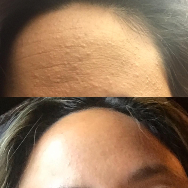 Lọ serum HA cấp ẩm siêu đỉnh, nhận về 26.000 đánh giá 5 sao trên Amazon hoá ra có giá chưa đến 300K - Ảnh 4. Lọ serum HA cấp ẩm siêu đỉnh, nhận về 26.000 đánh giá 5 sao trên Amazon hoá ra có giá chưa đến 300K - Ảnh 4.