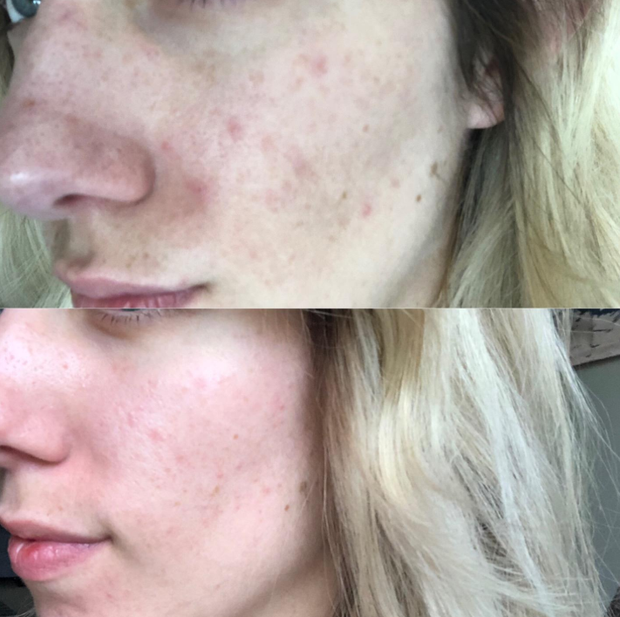 Lọ serum HA cấp ẩm siêu đỉnh, nhận về 26.000 đánh giá 5 sao trên Amazon hoá ra có giá chưa đến 300K - Ảnh 5. Lọ serum HA cấp ẩm siêu đỉnh, nhận về 26.000 đánh giá 5 sao trên Amazon hoá ra có giá chưa đến 300K - Ảnh 5.
