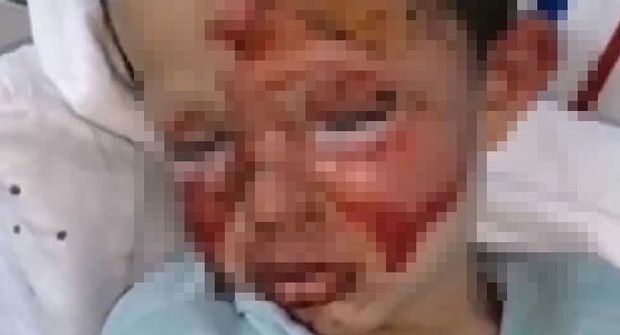 Cay cú trong cuộc chiến ly hôn với vợ, gã đàn ông ác quỷ trút giận lên đứa con trai 4 tuổi để lại cảnh tượng đau thắt ruột gan - Ảnh 2. Cay cú trong cuộc chiến ly hôn với vợ, gã đàn ông ác quỷ trút giận lên đứa con trai 4 tuổi để lại cảnh tượng đau thắt ruột gan - Ảnh 2.