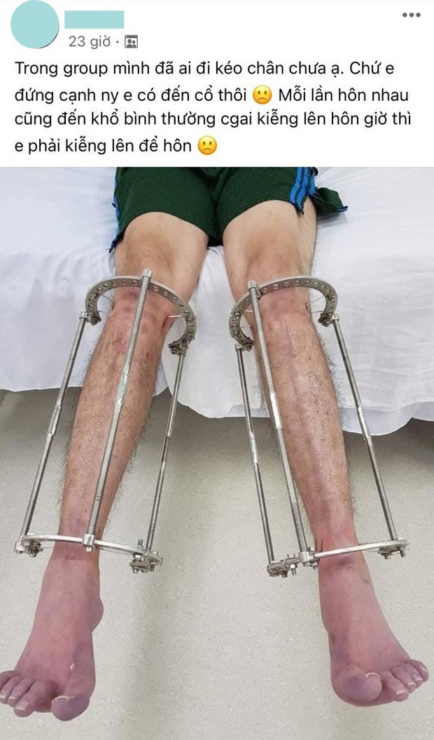 Thanh niên đòi kéo chân để vừa tầm đứng hôn bạn gái, người qua đường hiến kế trong 6 chữ: Dễ thế mà không nghĩ ra! - Ảnh 1.