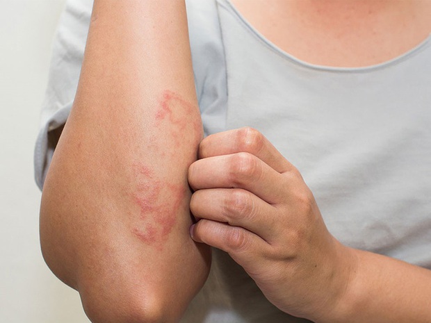 CẢNH BÁO: Hiểm họa khôn lường từ đá tắm tẩy da chết, chọn sai cách là hỏng da như chơi - Ảnh 5. CẢNH BÁO: Hiểm họa khôn lường từ đá tắm tẩy da chết, chọn sai cách là hỏng da như chơi - Ảnh 5.