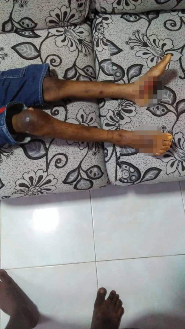 Tin tưởng gửi con cho bảo mẫu, 7 tháng sau người mẹ gặp lại đứa trẻ thân tàn ma dại, trông không khác gì nô lệ - Ảnh 4. Tin tưởng gửi con cho bảo mẫu, 7 tháng sau người mẹ gặp lại đứa trẻ thân tàn ma dại, trông không khác gì nô lệ - Ảnh 4.