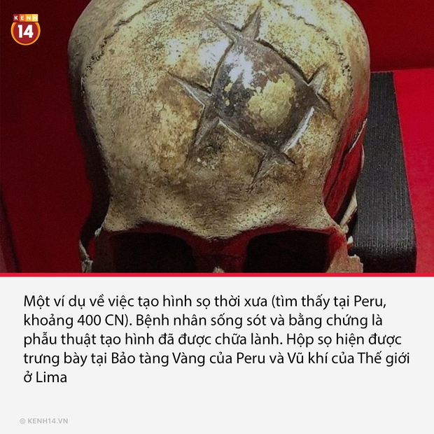 21 tác phẩm từ hàng trăm, hàng nghìn năm trước vẫn đủ cool để chúng ta bất ngờ tới tận ngày nay - Ảnh 9. 21 tác phẩm từ hàng trăm, hàng nghìn năm trước vẫn đủ cool để chúng ta bất ngờ tới tận ngày nay - Ảnh 9.