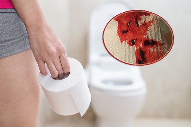 3 trạng thái bất thường khi đi đại tiện ngầm cảnh báo tế bào ung thư gan đang xâm chiếm cơ thể - Ảnh 1. 3 trạng thái bất thường khi đi đại tiện ngầm cảnh báo tế bào ung thư gan đang xâm chiếm cơ thể - Ảnh 1.