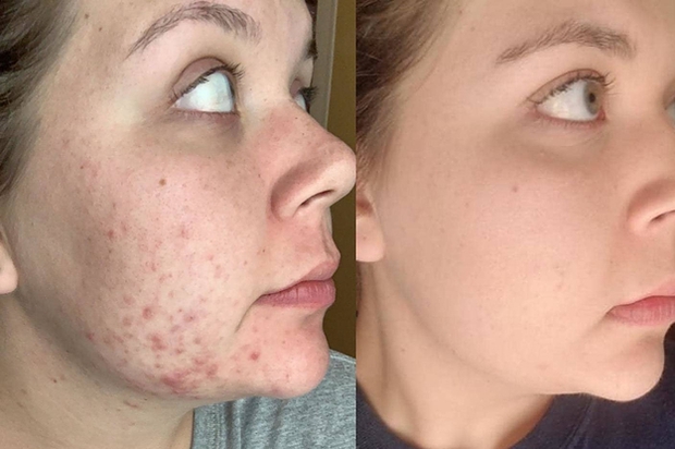 Serum tái tạo da chưa đến 400K nhận về 16 nghìn đánh giá 5 sao trên Amazon có gì đặc biệt? - Ảnh 6. Serum tái tạo da chưa đến 400K nhận về 16 nghìn đánh giá 5 sao trên Amazon có gì đặc biệt? - Ảnh 6.