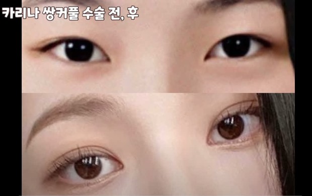 Điểm chung của Jungkook (BTS), Yuna (ITZY) và Karina (aespa): Hội visual hút fan nhưng đều vướng tranh cãi dao kéo - Ảnh 6. Điểm chung của Jungkook (BTS), Yuna (ITZY) và Karina (aespa): Hội visual hút fan nhưng đều vướng tranh cãi dao kéo - Ảnh 6.