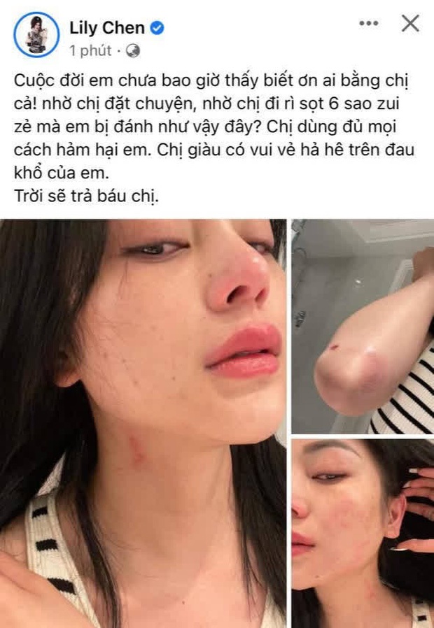 Lily Chen và drama chung bồ với Ngọc Trinh hay mỹ nhân vô danh đang mượn nữ hoàng nội y để nổi tiếng? - Ảnh 5. Lily Chen và drama chung bồ với Ngọc Trinh hay mỹ nhân vô danh đang mượn nữ hoàng nội y để nổi tiếng? - Ảnh 5.