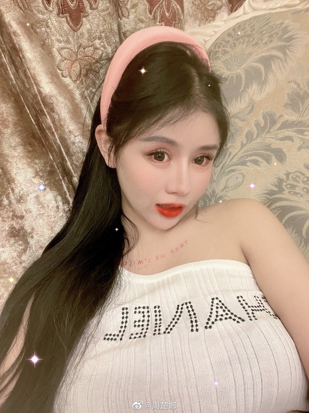 Cô bé 13 tuổi từng làm cả MXH khiếp vía vì chi chục tỷ phẫu thuật thẩm mỹ 60 lần đến biến dạng gây bất ngờ với nhan sắc tuổi 16 - Ảnh 6. Cô bé 13 tuổi từng làm cả MXH khiếp vía vì chi chục tỷ phẫu thuật thẩm mỹ 60 lần đến biến dạng gây bất ngờ với nhan sắc tuổi 16 - Ảnh 6.