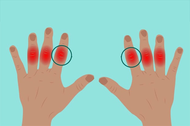 3 đặc điểm ở ngón tay giữa giúp bạn nhận biết gan đang có vấn đề - Ảnh 2.